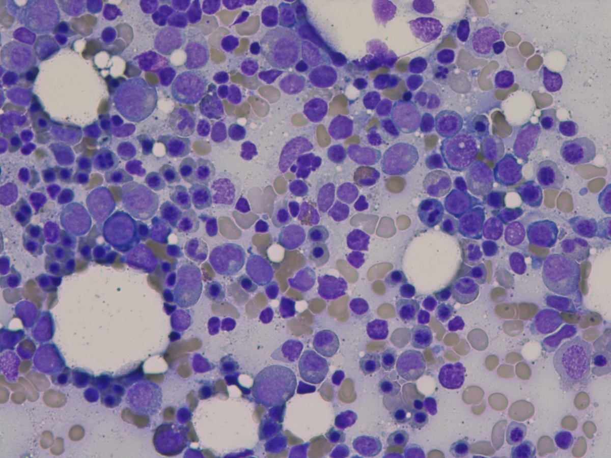 Bone marrow 10222012